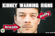 10 Signs Your Kidneys Are In Trouble