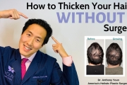How to Treat Your Thinning Hair Holistically and Thicken it Without Surgery