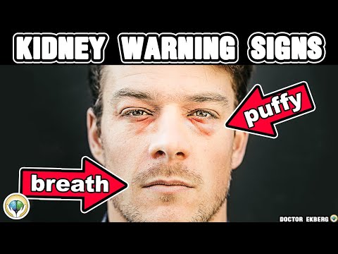 10 Signs Your Kidneys Are In Trouble