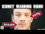 10 Signs Your Kidneys Are In Trouble