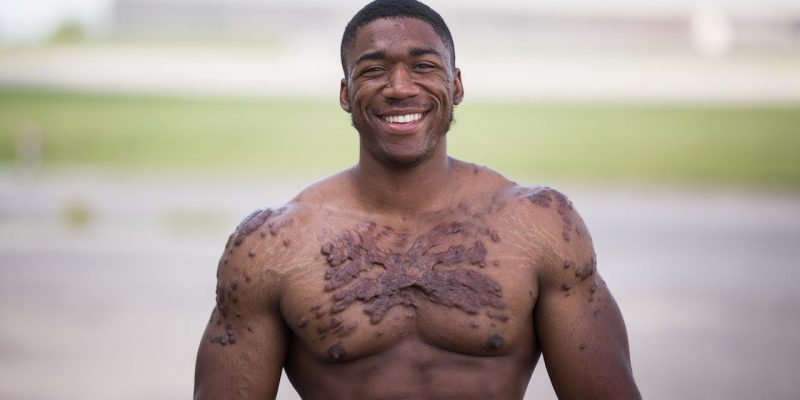 My Scars Won’t Kill My Bodybuilding Dreams | UNBREAKABLE ME